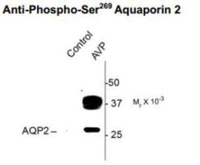 Western Blot: Aquaporin-2 [p Ser269] Antibody [NBP1-48314]